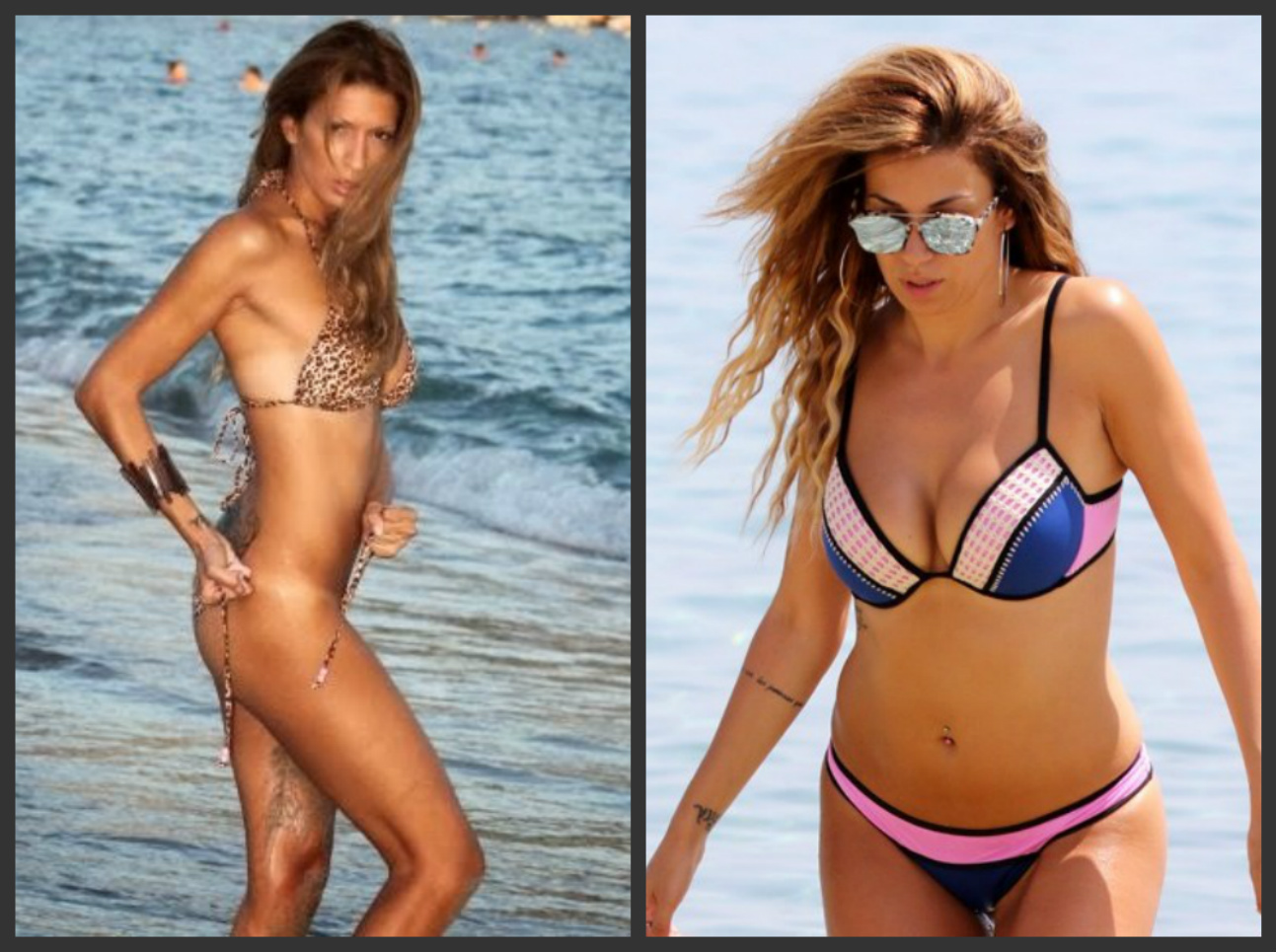 10 εντυπωσιακές Ελληνίδες πριν και μετά την πλαστική στήθους (Pics)