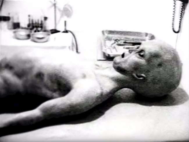 Παιδικό μέγεθος, διογκωμένη κοιλιά: Το φιλμ των 17 λεπτών με την πρώτη νεκροψία εξωγήινου έσπασε όλα τα ρεκόρ τηλεθέασης (Pics)