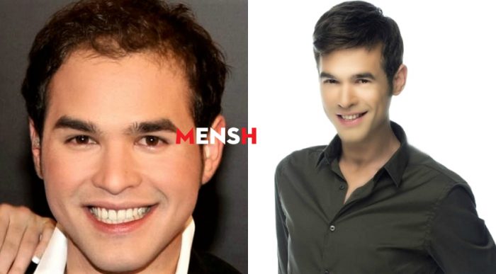 Πριν και μετά! 5 διάσημοι Έλληνες που μέσα σε μια νύχτα… έβγαλαν μαλλιά (Pics)