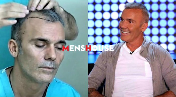 Πριν και μετά! 5 διάσημοι Έλληνες που μέσα σε μια νύχτα… έβγαλαν μαλλιά (Pics)