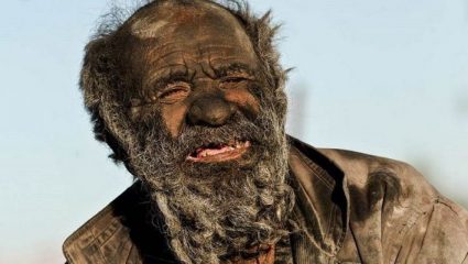 Ο πιο βρώμικος άνθρωπος του κόσμου: Έχει να κάνει μπάνιο 67 χρόνια, τρώει ψοφίμια και καπνίζει περιττώματα, αλλά είναι… υγιέστατος!