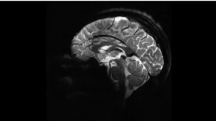 Ο ανθρώπινος εγκέφαλος όπως τον κατέγραψε ο ισχυρότερος μαγνητικός τομογράφος στον κόσμο